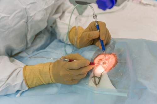 intervento con laser terapia