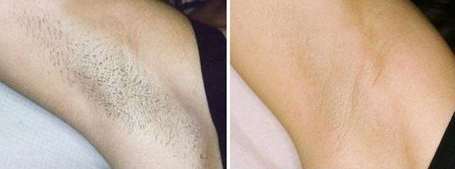 lady's armpit