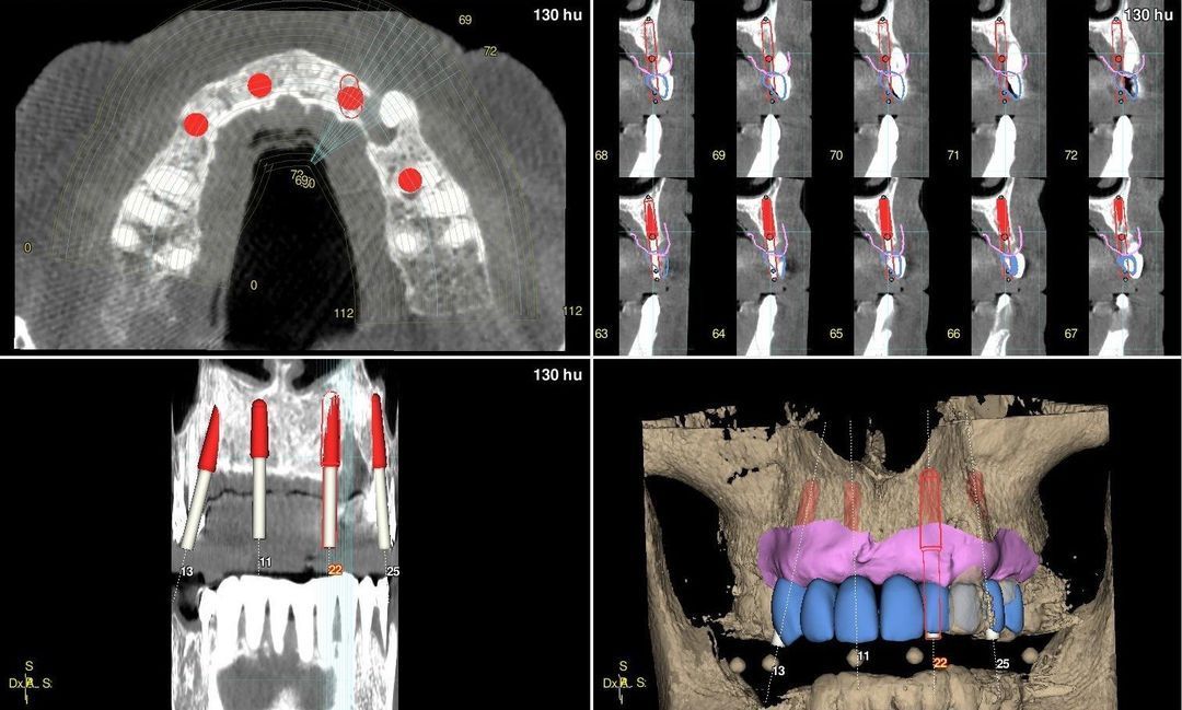 software Arco SynSurgery