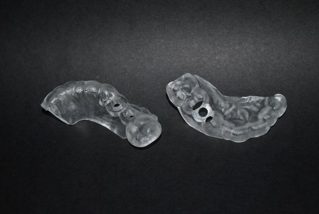 analisi dentatura con software Arco SynSurgery