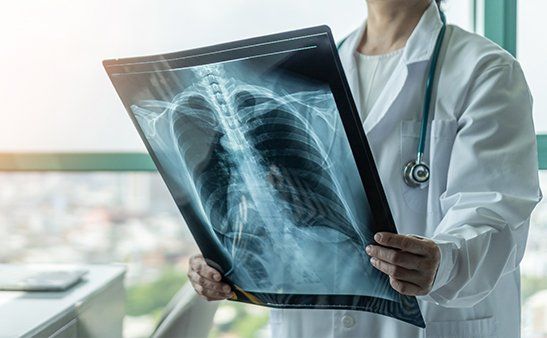 Pulmonary Embolus — Bethlehem, PA — Salib Oncology Pulmonary Embolus — Bethlehem, PA — Salib Oncology