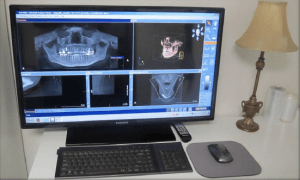 Dental Imaging Process — Pinole, CA — Dalia E. Perez-Salinas, D.D.S. Dental Imaging Process — Pinole, CA — Dalia E. Perez-Salinas, D.D.S.
