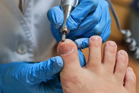 Podiatrist doing a foot procedure — Diabetic foot care in Westborough, MA Podiatrist doing a foot procedure — Diabetic foot care in Westborough, MA