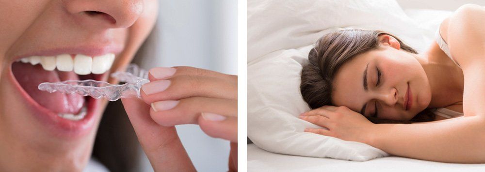 Woman having a good night sleep after night guards have been in used
