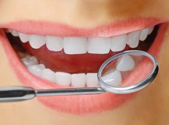 Beautiful Smile with White Teeth - Teeth Whitening in Terre Haute, IN