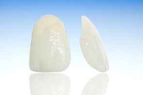 White Tooth — Cosmetic Dentists in Terre Haute, IN White Tooth — Cosmetic Dentists in Terre Haute, IN