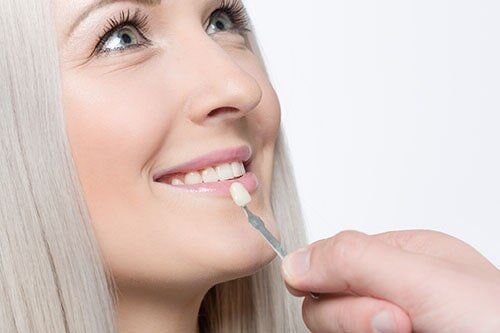 Teeth Whitening — Dental Services in Victorville, CA Teeth Whitening — Dental Services in Victorville, CA