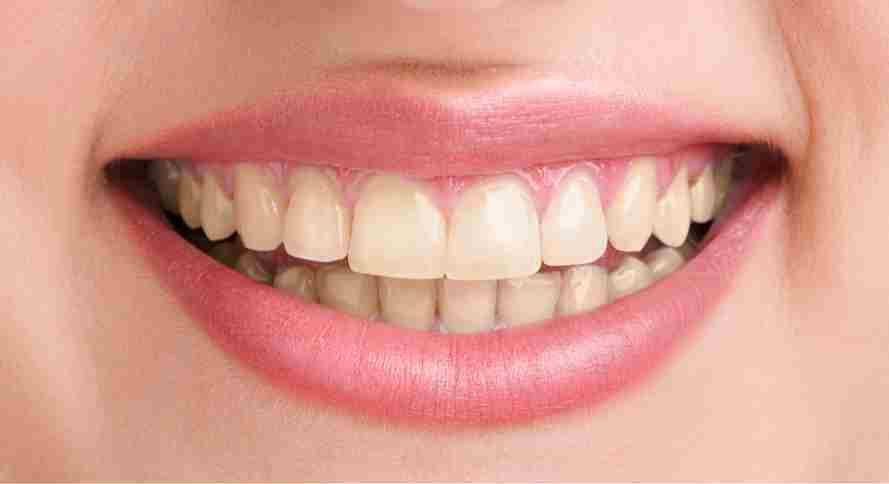 Primer plano de una boca sonriente con dientes visibles y labios rosados.