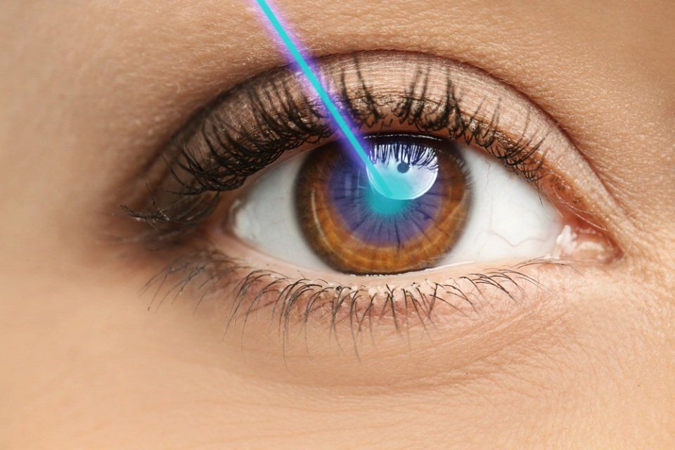 tecnica laser