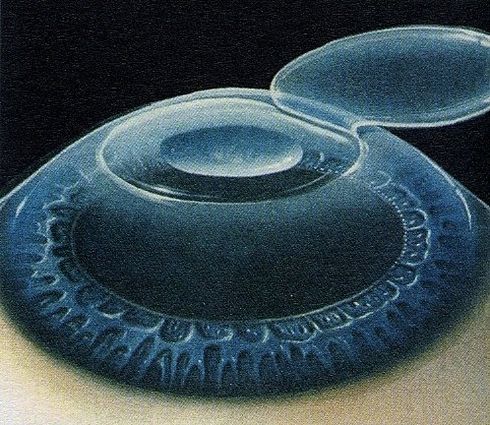 FEMTO-LASIK