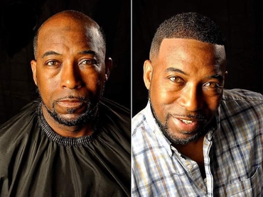 Men Hair Replacement