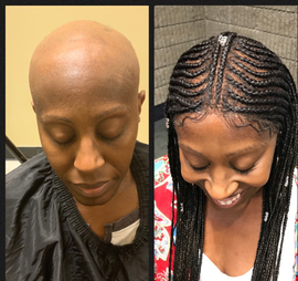 Women Hair Replacement