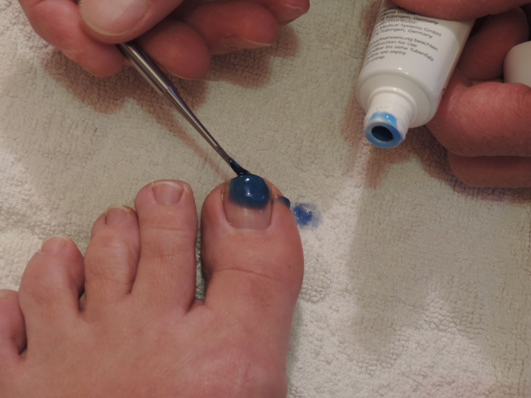 applicazione gel contro micosi