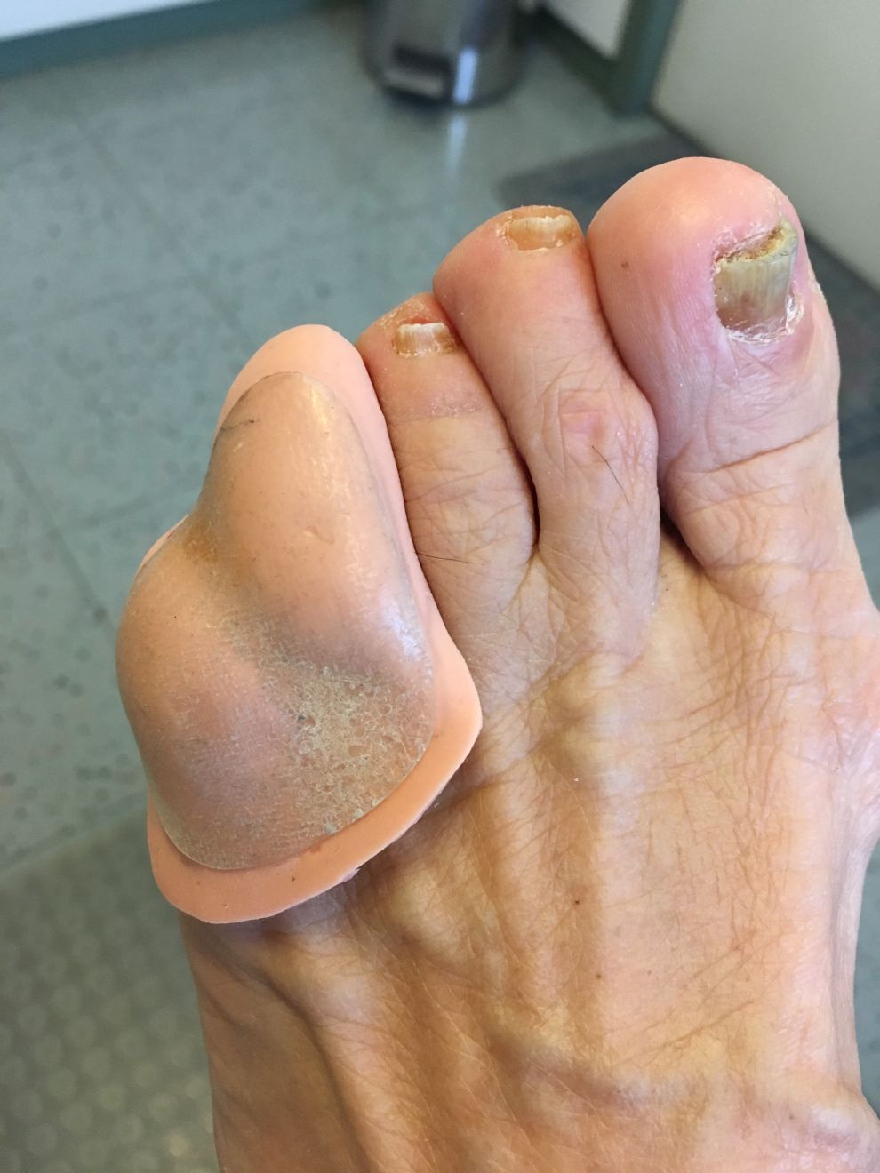 protezioni per dita dei piedi