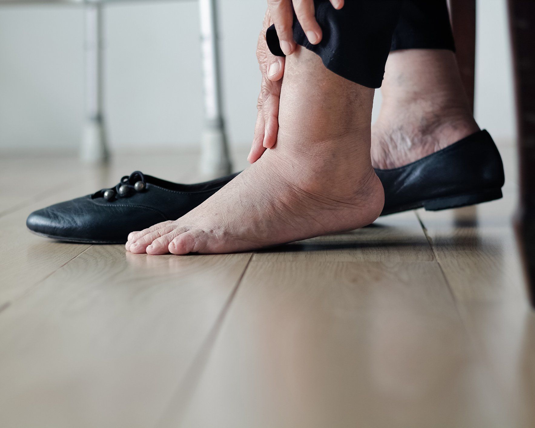 Diabetes Podiatrist – Elderly Woman Swollen Feet in West Chester, PA Diabetes Podiatrist – Elderly Woman Swollen Feet in West Chester, PA