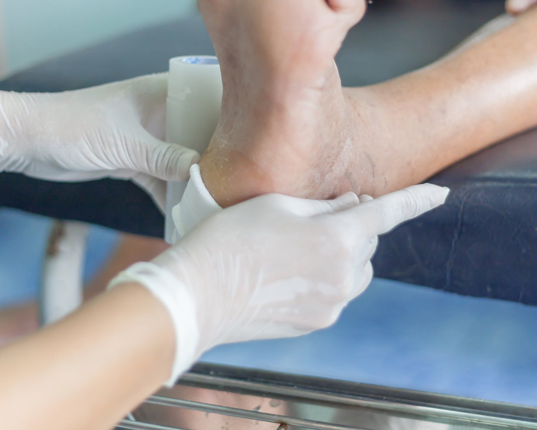 Foot Wound Care – Infected Wound in West Chester, PA Foot Wound Care – Infected Wound in West Chester, PA