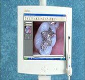 Intraoral camera — CEREC in Katy, TX Intraoral camera — CEREC in Katy, TX