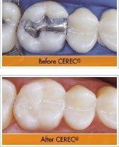 Before and After — Dentist in Katy, TX Before and After — Dentist in Katy, TX