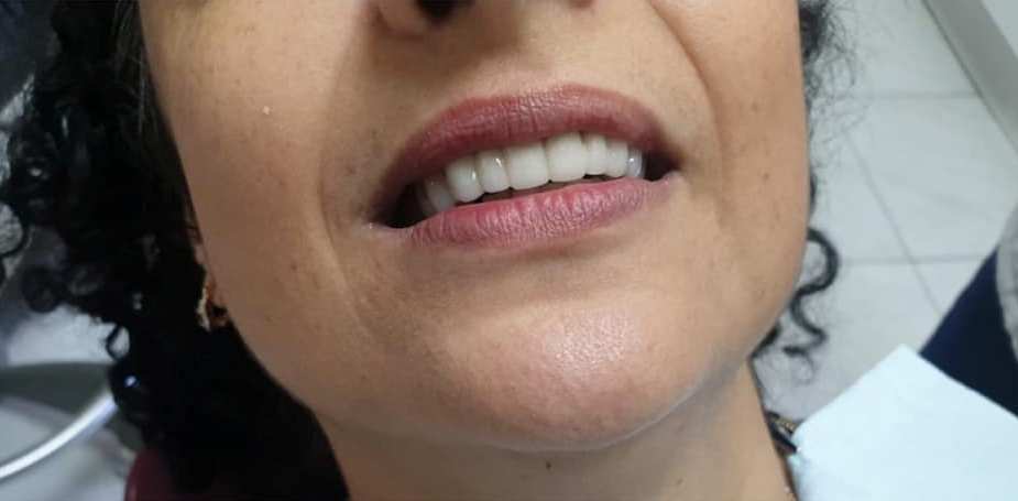 ד