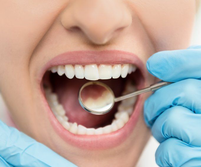 Horizontal color close-up image of young woman having dental exam.