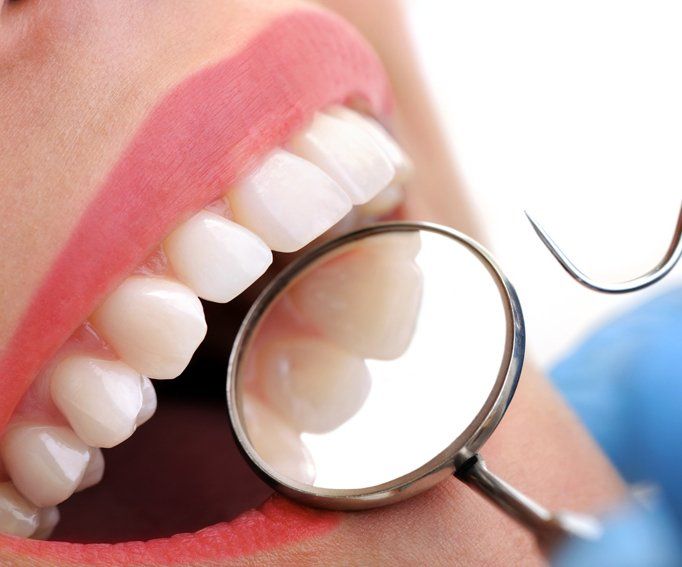 Dental Inspection - XXXL Image