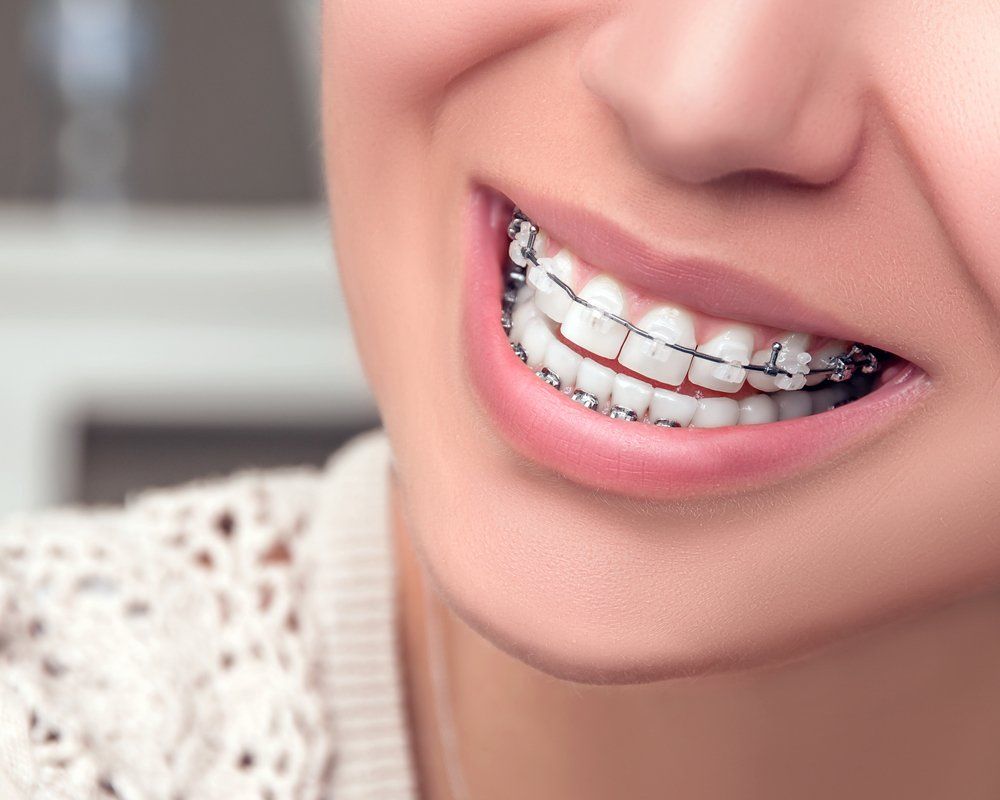 dentista mentre mostra delle protesi dentali