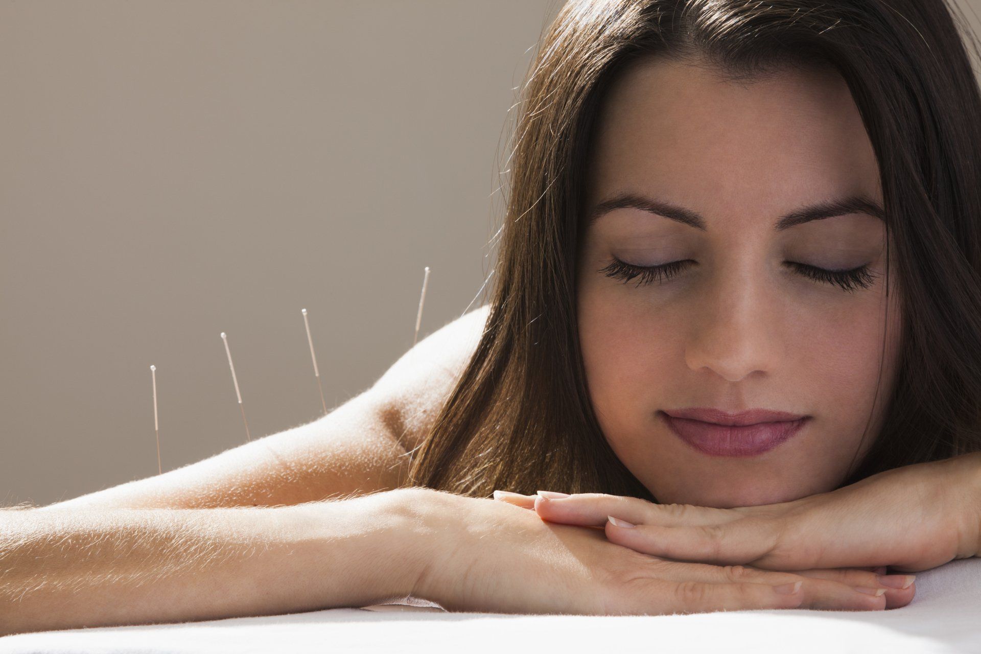 Acupuncture treatments