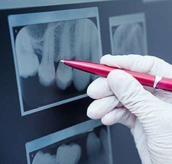 Teeth X-Ray — Dental Care in Burgettstown, PA Teeth X-Ray — Dental Care in Burgettstown, PA