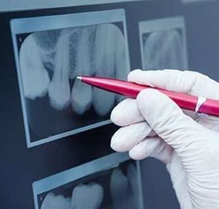 Teeth X-Ray — Dental Care in Burgettstown, PA Teeth X-Ray — Dental Care in Burgettstown, PA