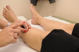 acupuncture-benefits