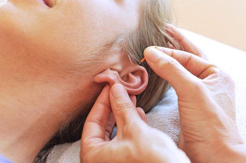 acupuncture-near-me-therapy