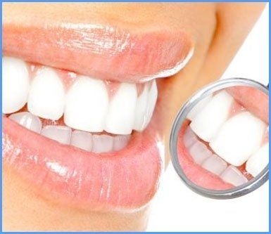 igiene dentale cura denti