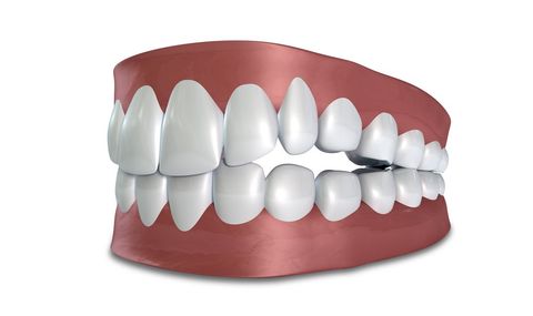 Dr. Young Nam Kim Orthodontist | What is an openbite