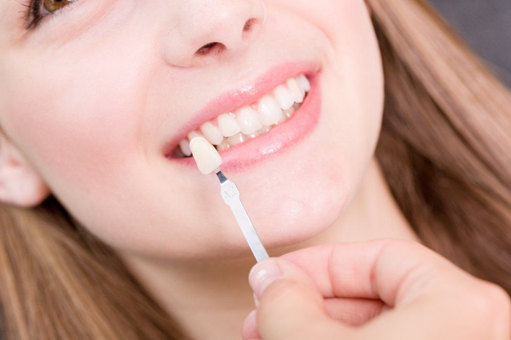 Dental Crowns