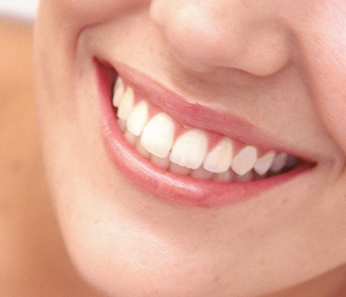 Dental Veneers Flushing
