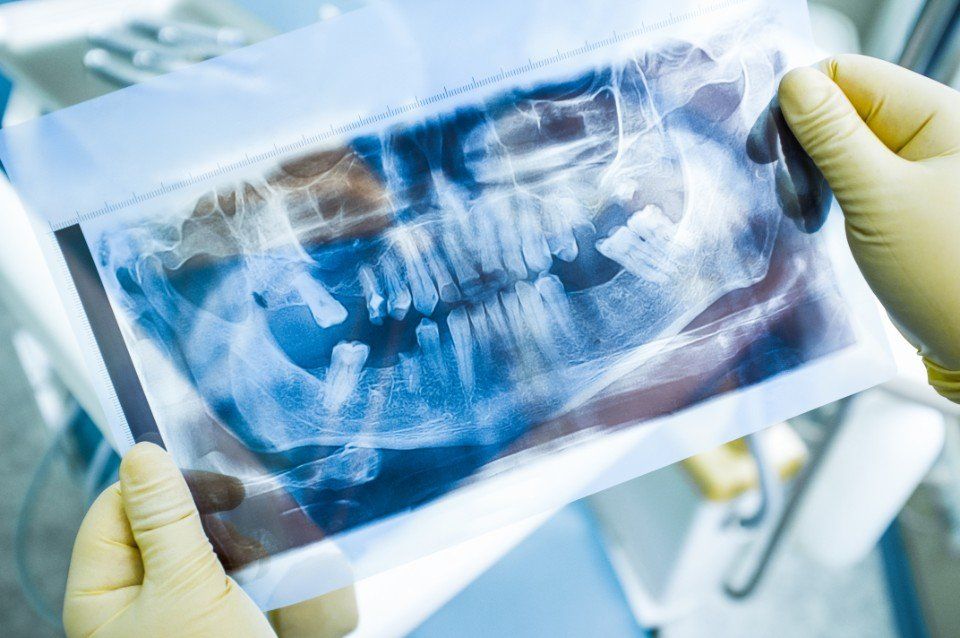 Panoramica dentale