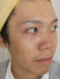 フェイシャルのビフォー
