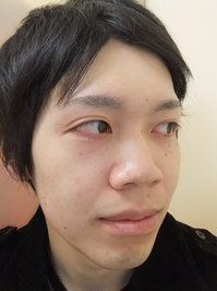 フェイシャルのアフター