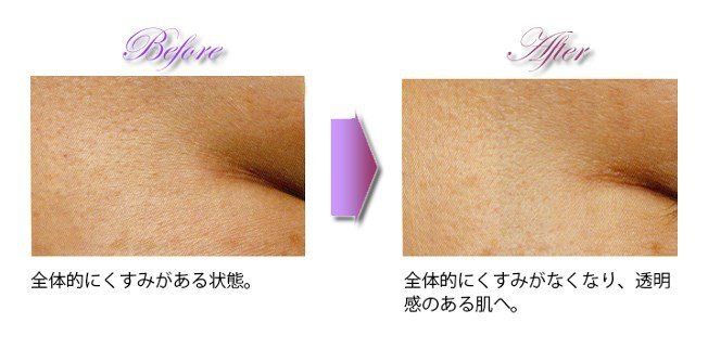 小ジワのビフォー・アフター