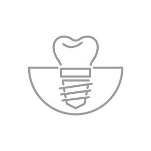 dental implant