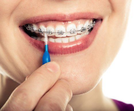 woman cleaning her braces