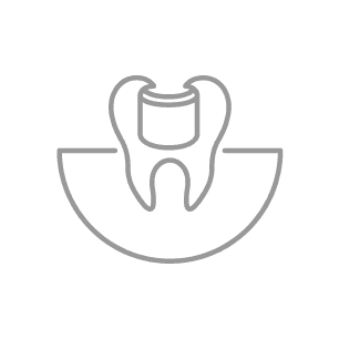 tooth filling