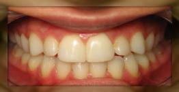 Advanced Dental Care