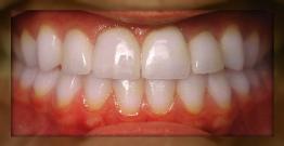 Advanced Dental Care