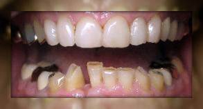 Advanced Dental Care