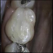 Advanced Dental Care