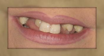 Advanced Dental Care