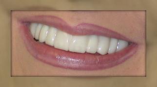 Advanced Dental Care