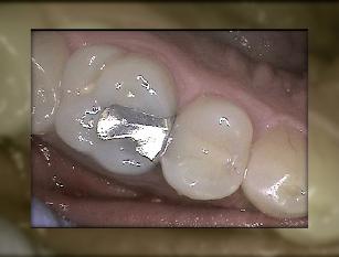 Advanced Dental Care