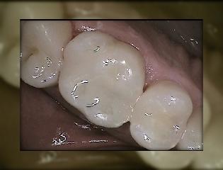 Advanced Dental Care